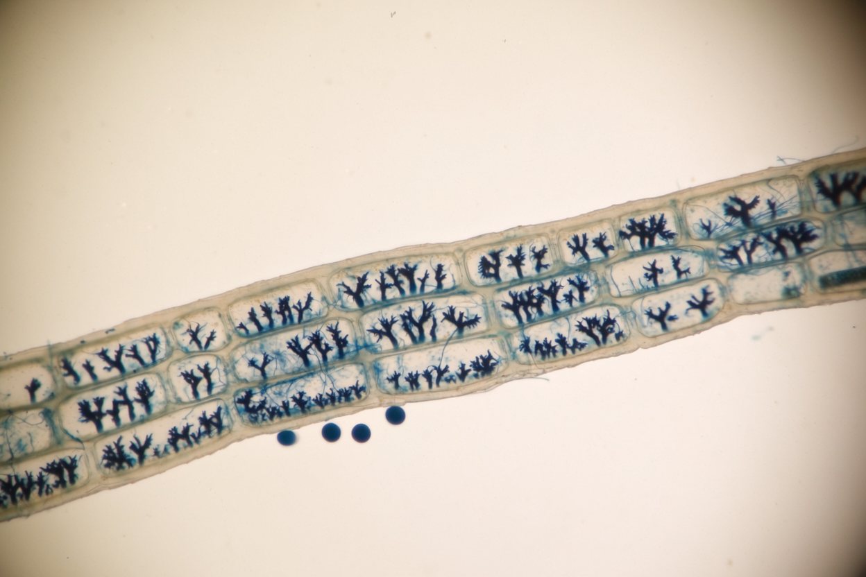 A corn root under the microscope, stained blue: the fungus inside the cells, spores beside it